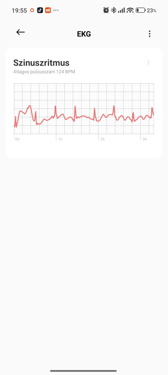 Screenshot 2026 08 17 19 55 41 874 com.xiaomi.wearable